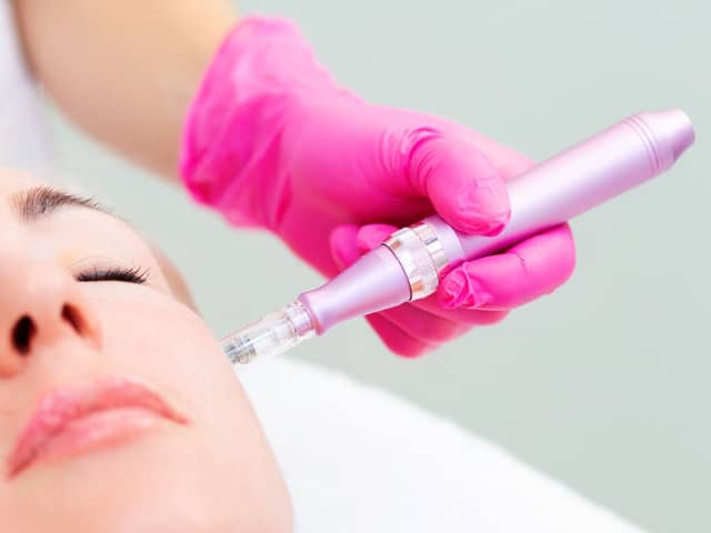 Benefits of Microneedling