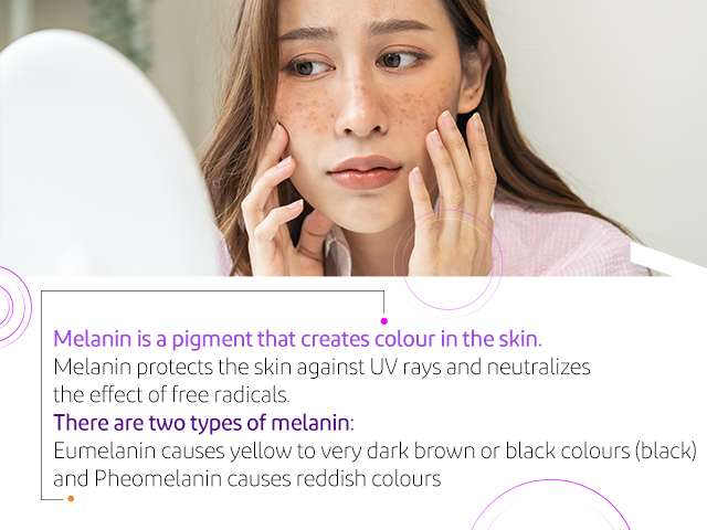 Melanin is a pigment that creates colour in the skin