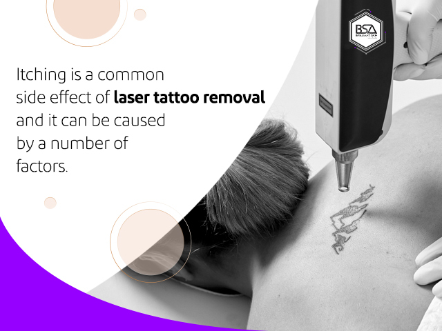 Important Things to Know About Laser Tattoo Removals 