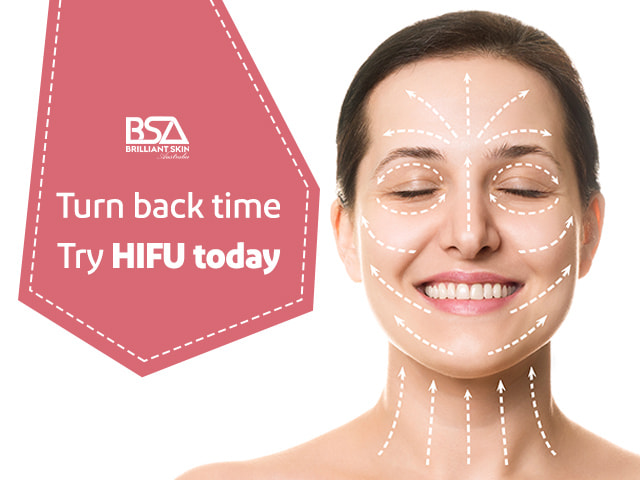 MFU is the latest skin lifting technology