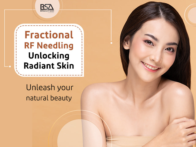 Facial beauty with fractional RF needling-min