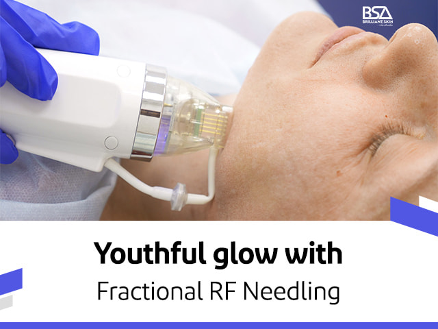 Fractional RF needling without side effects-min