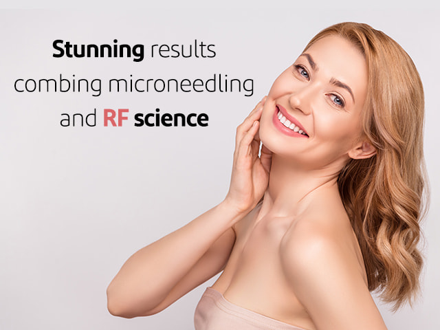 Increasing collagen production with fractional RF needling-min