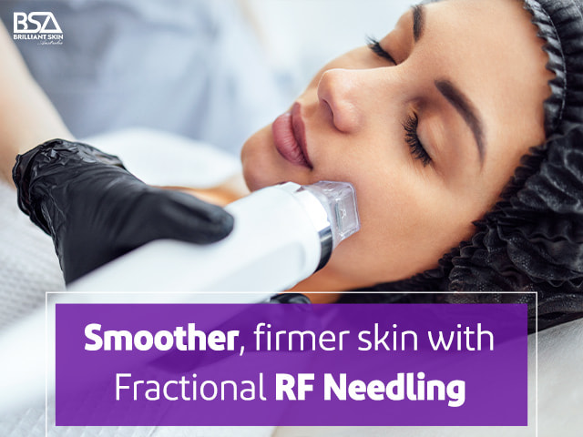 Skin radiance with fractional RF needling-min