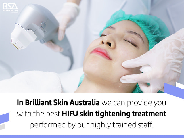 HIFU skin tightening treatment