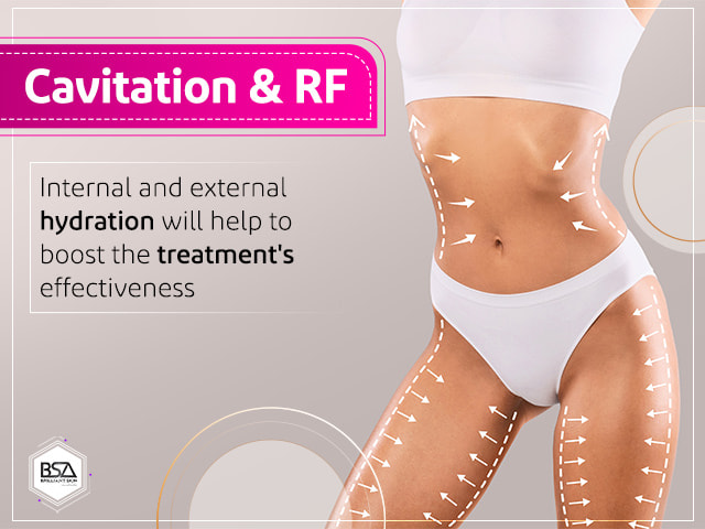 Best RF Cavitation Treatment in Siliguri – Slimfit Clinic