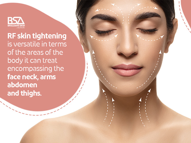 RF Skin Tightening Sydney: Achieving Youthful Skin Without Surgery