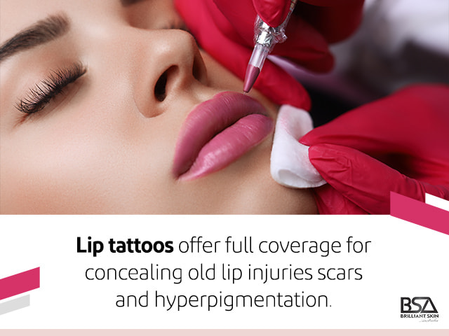 Lip Tattoo Removal