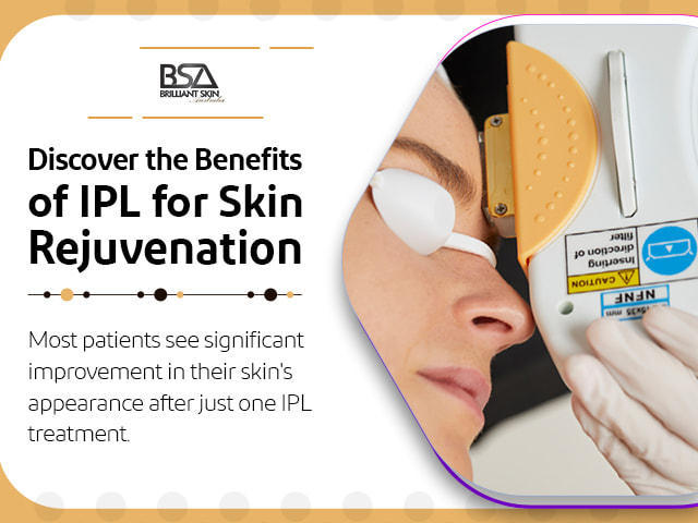 IPL for skin Rejuvenation