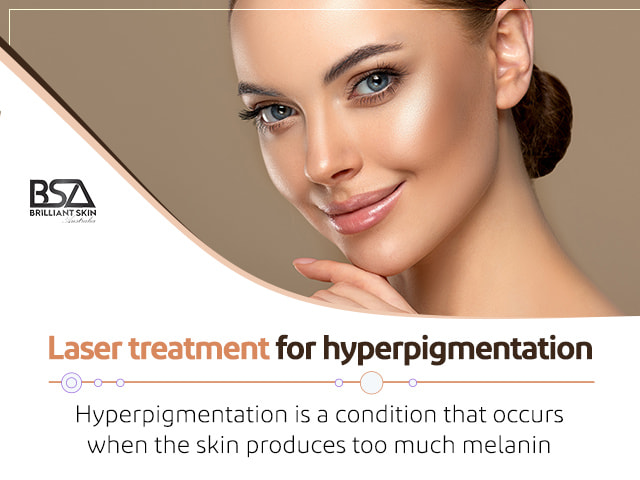 Achieve Flawless Skin With Laser For Hyperpigmentation Removal