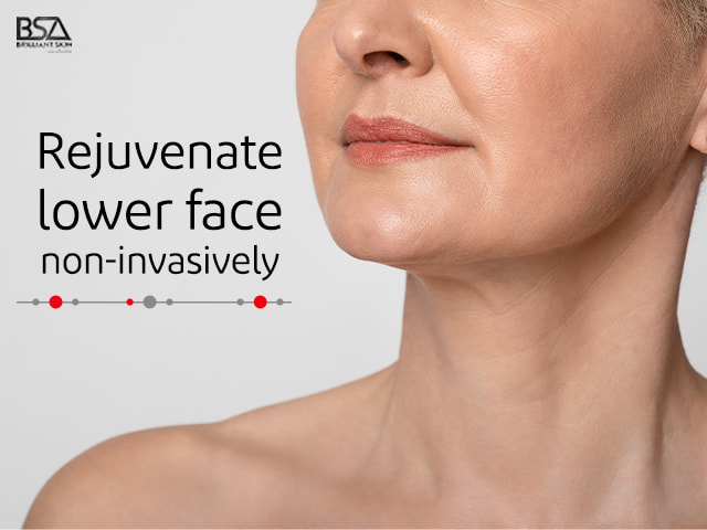 Rejuvenate lower face 