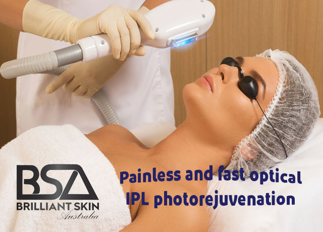 painless IPL photorejuvenation