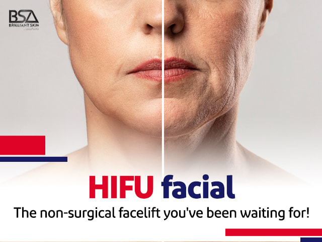 hifu facial