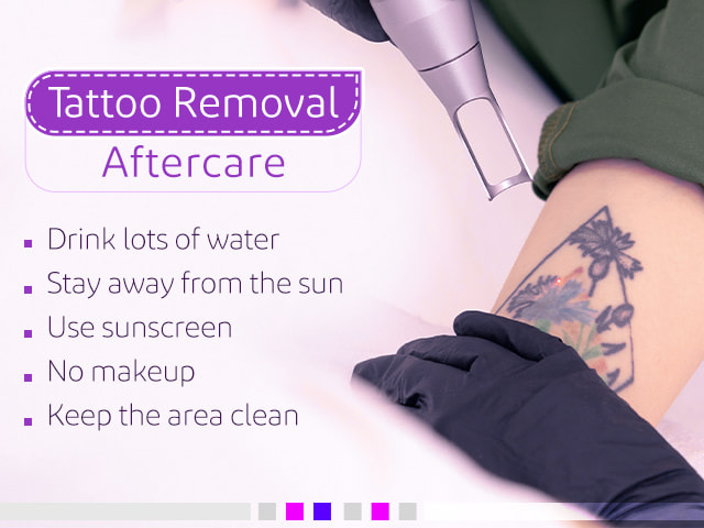 Tattoo Removal